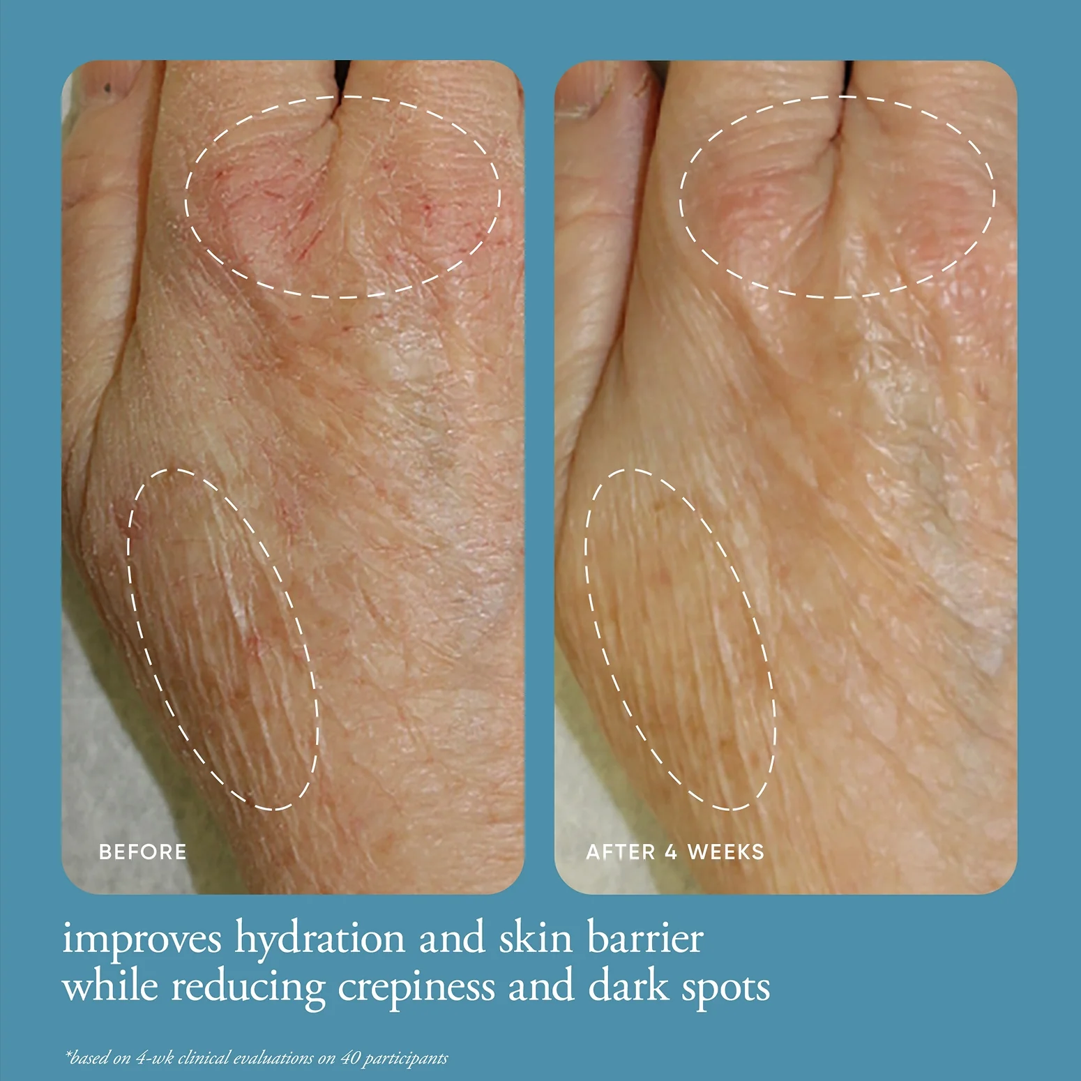 147-fragrance-free-multi-restorative-hand-cream-4.webp fragrance free multi-restorative hand cream