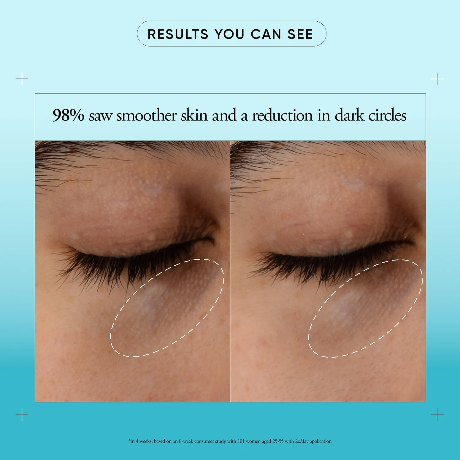 207-dark-circle-brightening-eye-cream-4.webp dark circle brightening eye cream