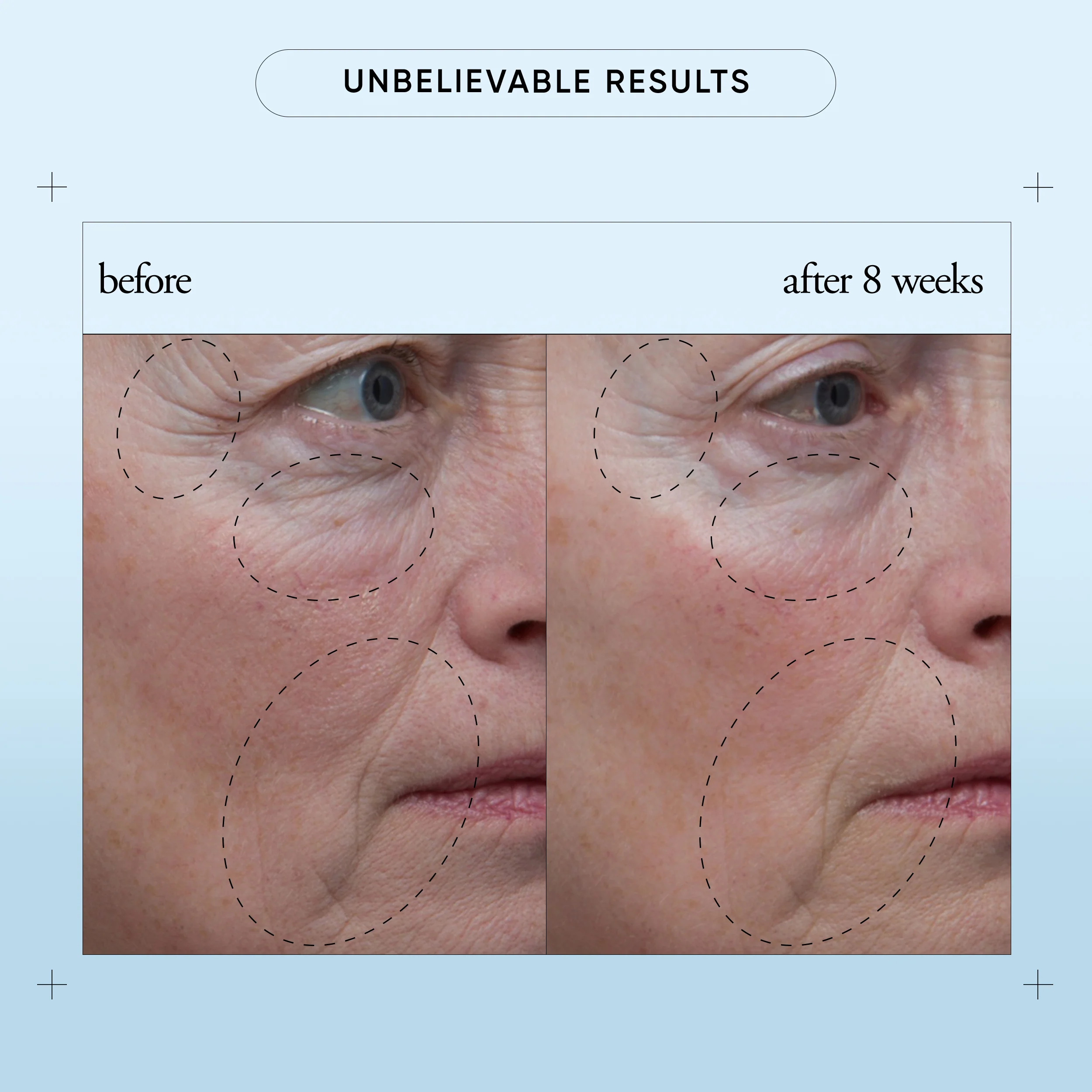 79-facial-firming-serum-4.webp facial firming serum