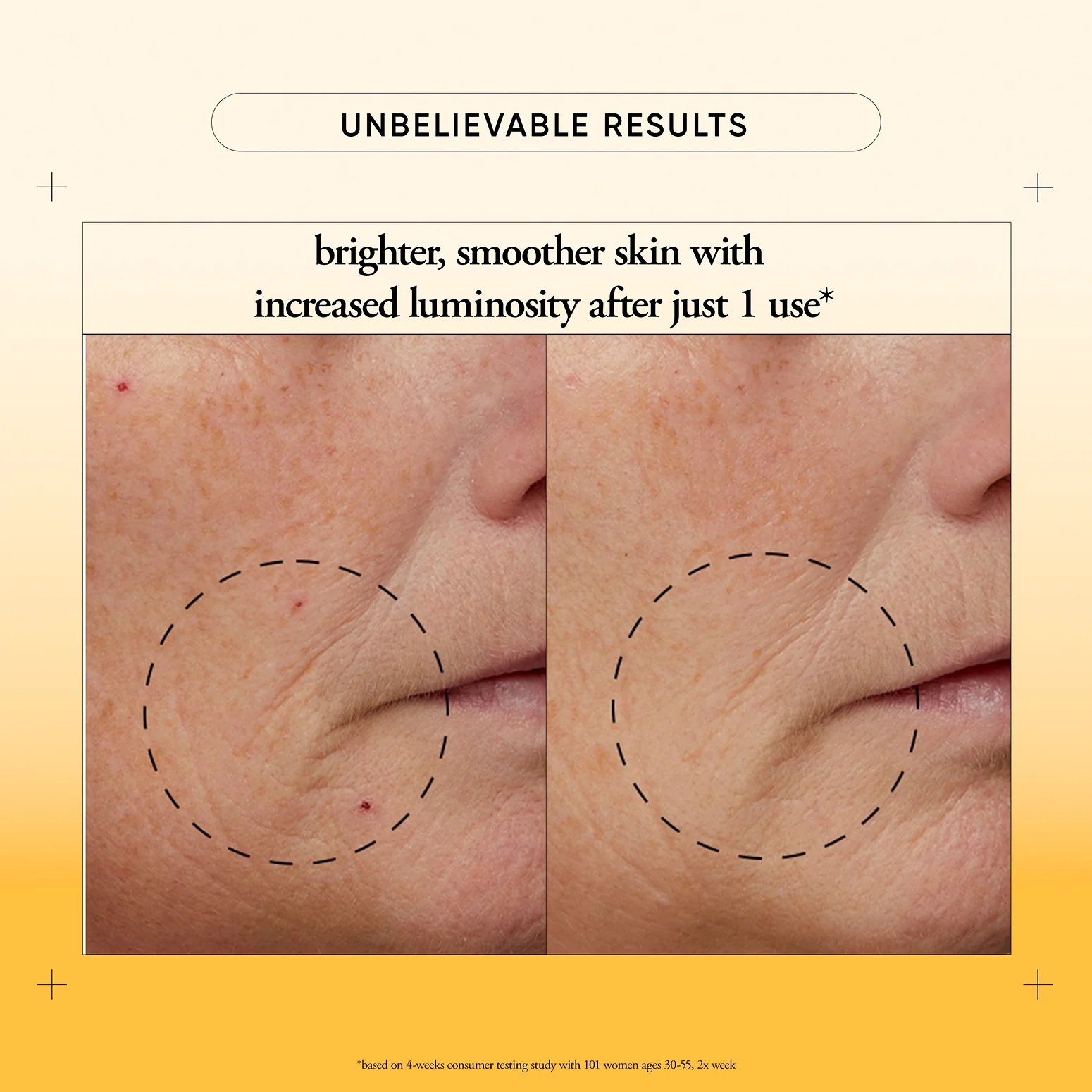 84-vitamin-c-resurfacing-peel-kit-4.webp vitamin c resurfacing peel kit