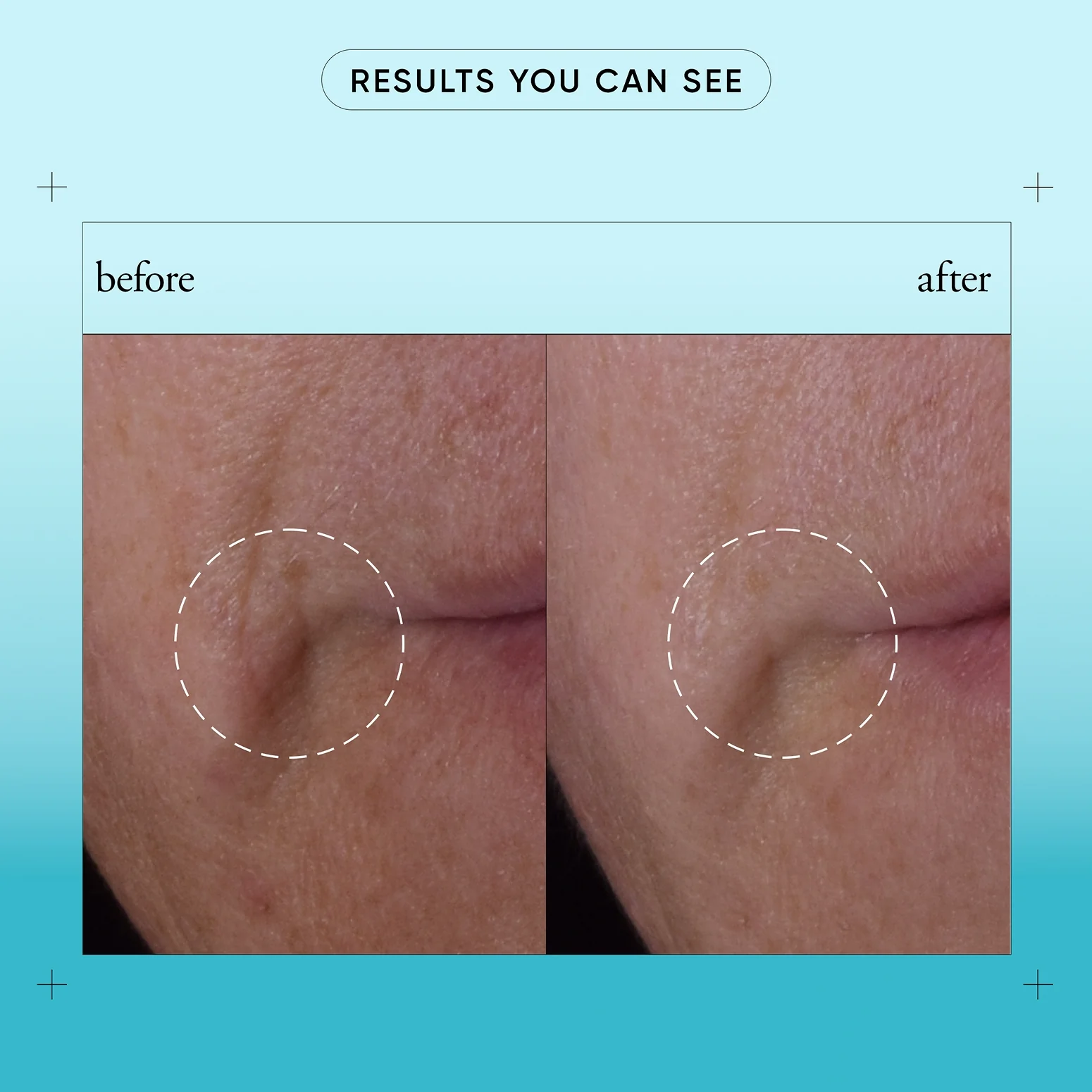 89-bouncy-skin-reactivating-serum-4.webp bouncy skin reactivating serum